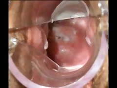 Speculum Cum